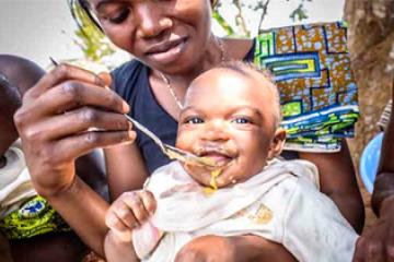 Feeding of children under 5 in Burkina Faso